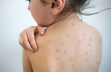 SAAM